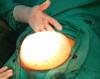 precise-surgery